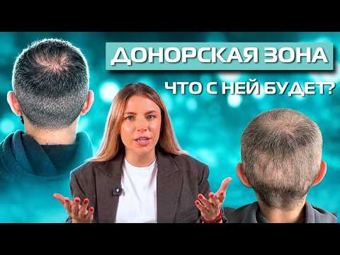 Пересадка волос: донорская зона, лимит графтов и риски